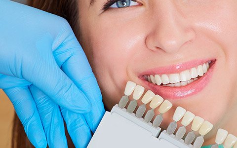 Free porcelain veneers consultation coupon