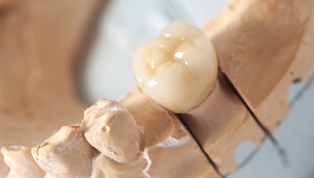 Model of tooth with dental crown