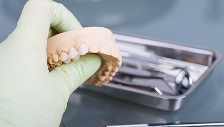 Hand holding a dental model with fixed bridge restoration