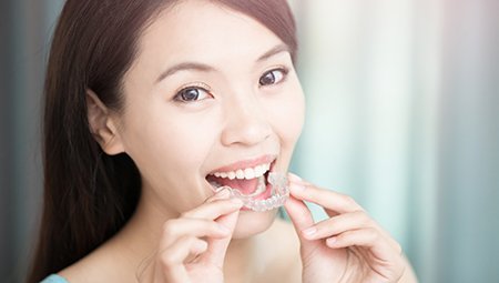 Woman inserting her Invisaling aligner