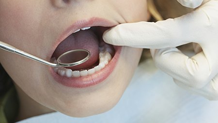 Patient receiving oral cancer screening