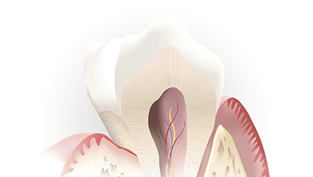 Animation of the inside of the tooth