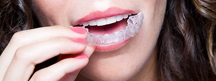 Woman placing Invisalign trays