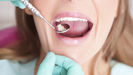 Patient receiving dental exam