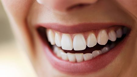 Closeup of brilliantly white teeth