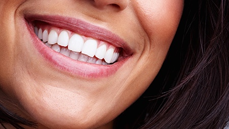 Closeup of smile following teeth whitening